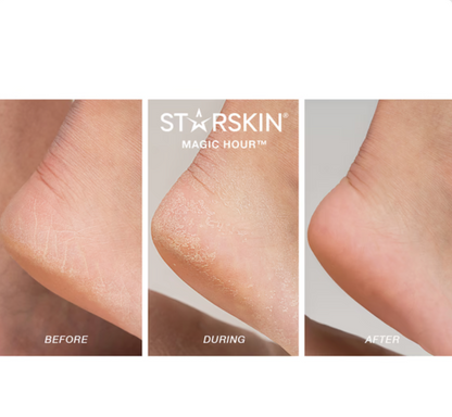 avant apres utilisation chaussettes exfoliantes starskin